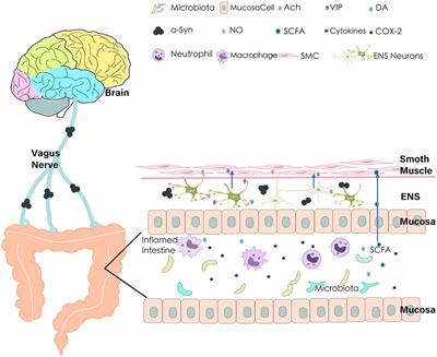 New Understanding on the Pathophysiology and Treatment of Constipation in Parkinson’s Disease